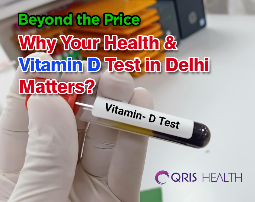 Beyond the Price: Why Your Health & Vitamin D Test in Delhi Matters